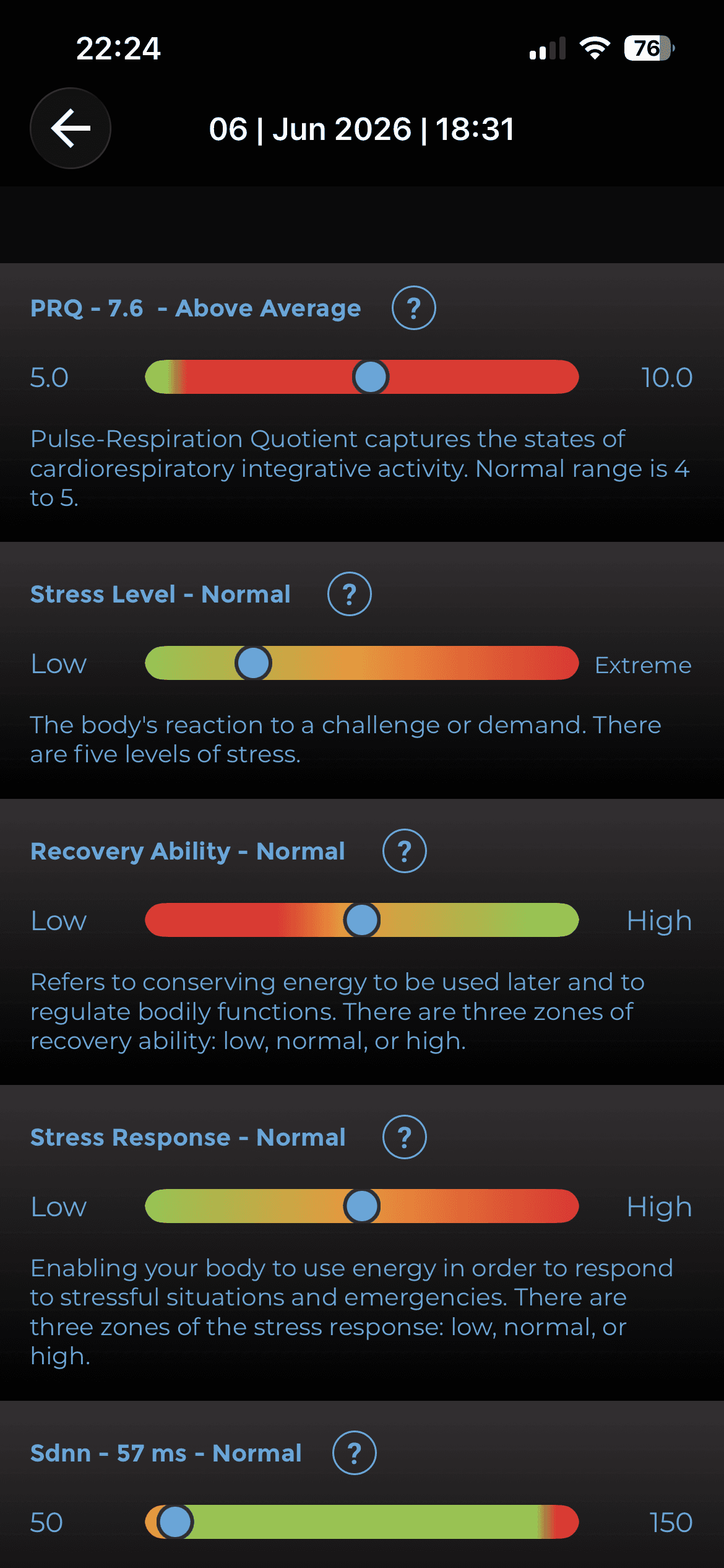 Stress level, recovery and stress response panel from the scan app.